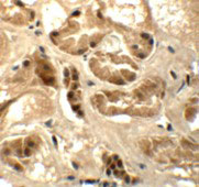 2 - ATAD3B Antibody ASC11341