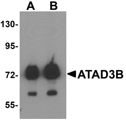 1 - ATAD3B Antibody ASC11341