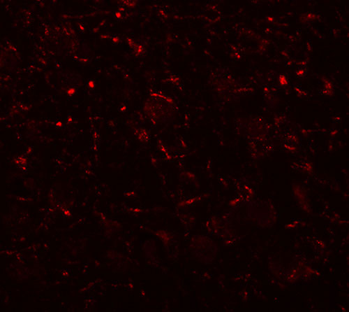 3 - AP3B2 Antibody ASC11344