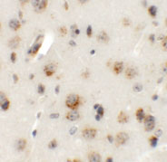 2 - AP3B2 Antibody ASC11344