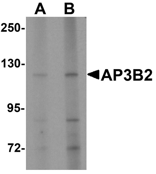 1 - AP3B2 Antibody ASC11344