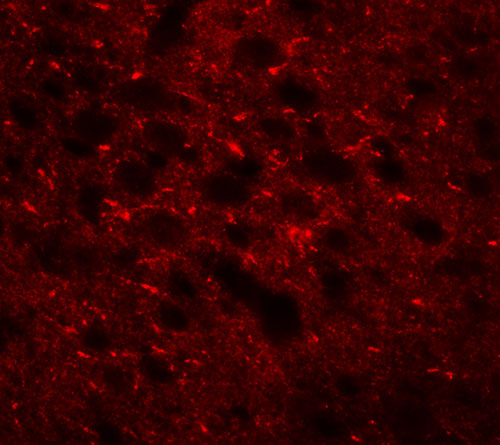 3 - TMEM88 Antibody ASC11345