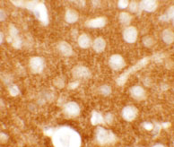 2 - TMEM88 Antibody ASC11345