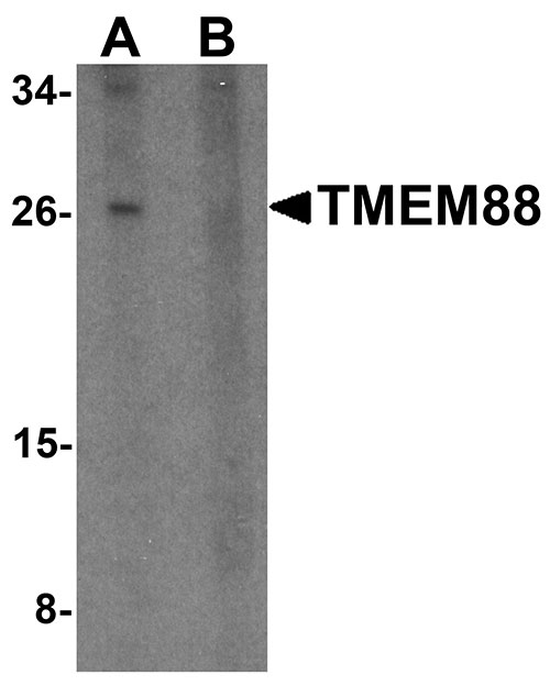 1 - TMEM88 Antibody ASC11345