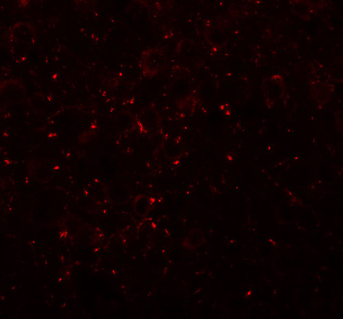 3 - CCDC141 Antibody ASC11346