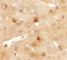 2 - CCDC141 Antibody ASC11346