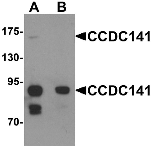 1 - CCDC141 Antibody ASC11346