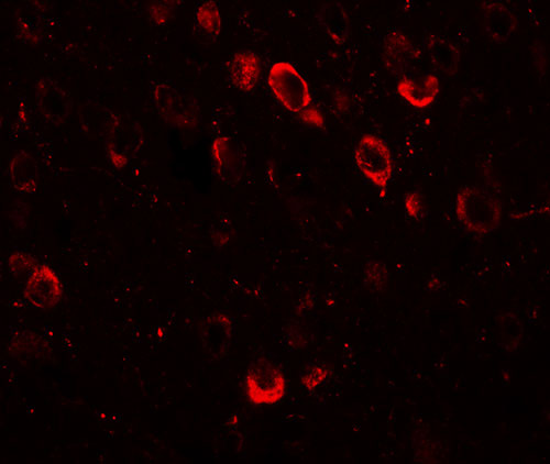 3 - SPRYD2 Antibody ASC11347