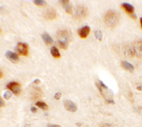 2 - SPRYD2 Antibody ASC11347