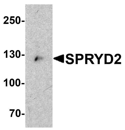 1 - SPRYD2 Antibody ASC11347