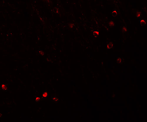 3 - SPRYD3 Antibody ASC11348
