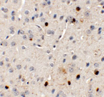 2 - SPRYD3 Antibody ASC11348