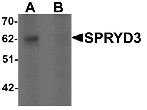 1 - SPRYD3 Antibody ASC11348