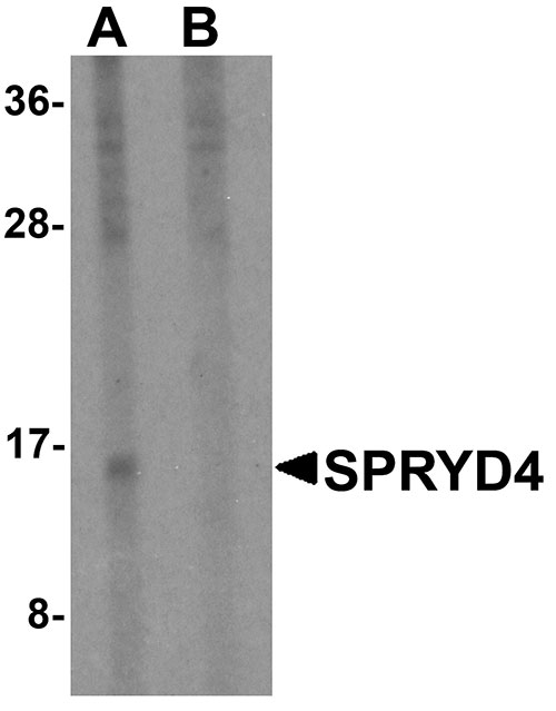 1 - SPRYD4 Antibody ASC11349
