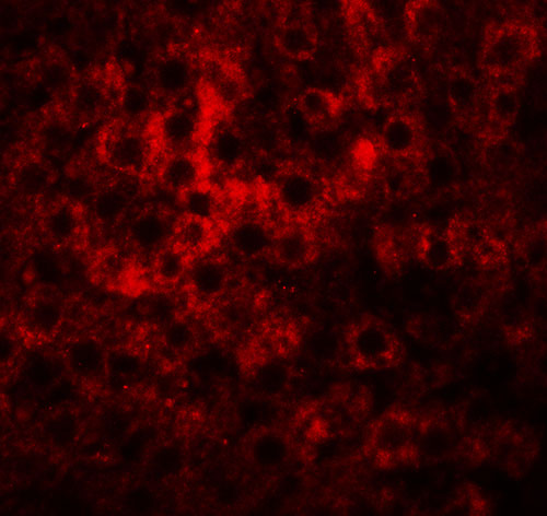 3 - HDGFRP2 Antibody ASC11351