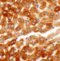 2 - HDGFRP2 Antibody ASC11351