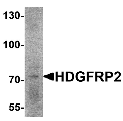 1 - HDGFRP2 Antibody ASC11351