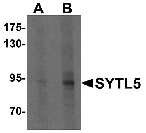 1 - SYTL5 Antibody ASC11352