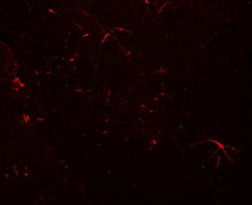 3 - TMEM204 Antibody ASC11353