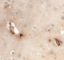 2 - TMEM204 Antibody ASC11353