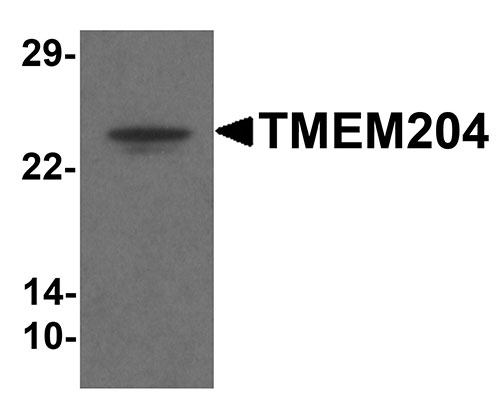 1 - TMEM204 Antibody ASC11353