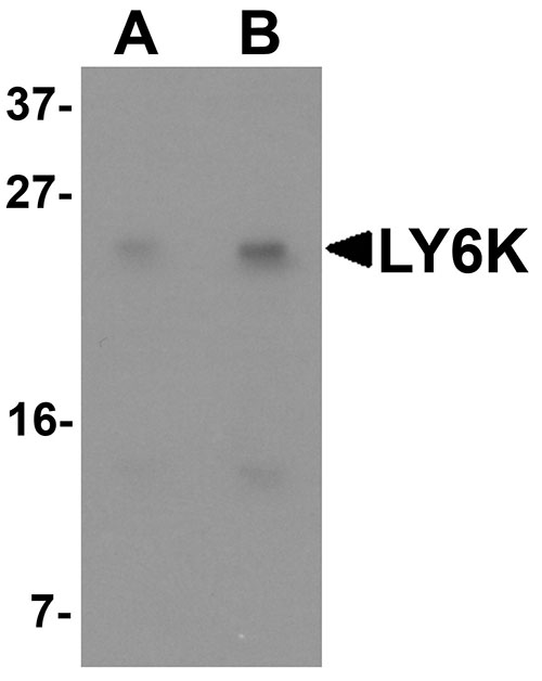 1 - LY6K Antibody ASC11357