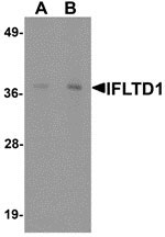 1 - IFTLD1 Antibody ASC11362