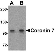 1 - Coronin 7 Antibody ASC11364