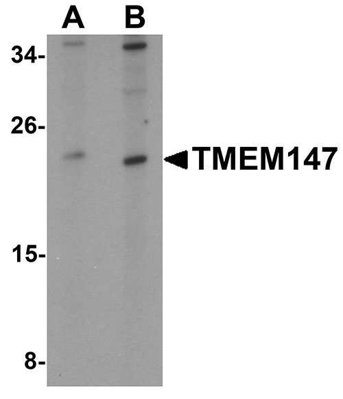 1 - TMEM147 Antibody ASC11365