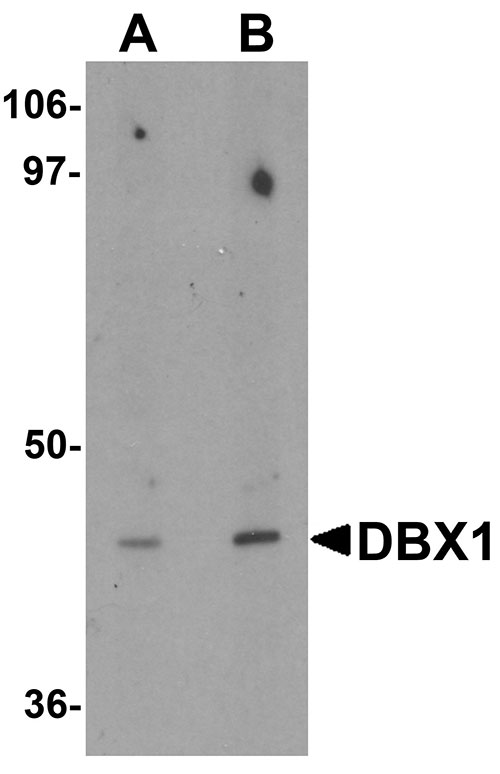 1 - DBX1 Antibody ASC11366