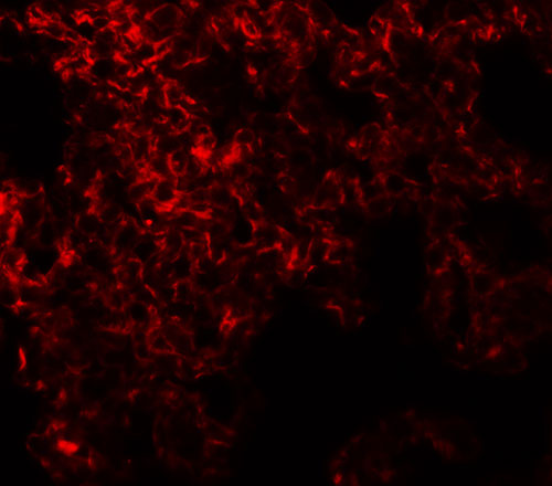 3 - NETO1 Antibody ASC11370