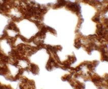 2 - NETO1 Antibody ASC11370