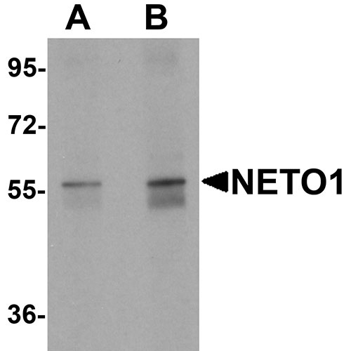 1 - NETO1 Antibody ASC11370
