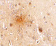 2 - SEC62 Antibody ASC11371