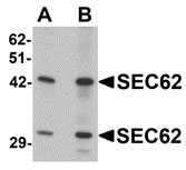 1 - SEC62 Antibody ASC11371