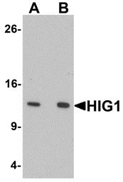 1 - HIG1 Antibody ASC11375