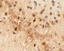 2 - NEUCRIN Antibody ASC11377