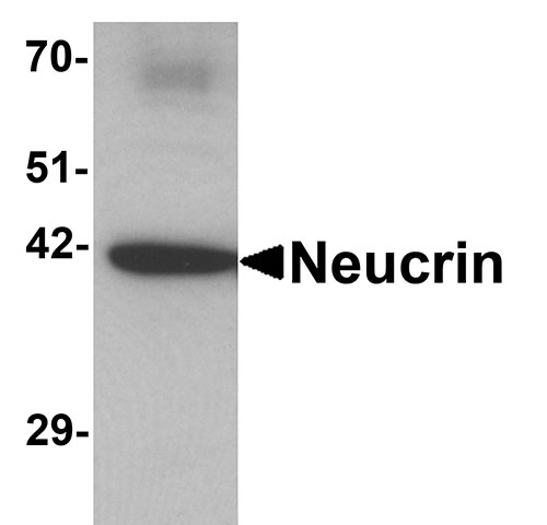 1 - NEUCRIN Antibody ASC11377
