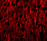 3 - RILPL1 Antibody ASC11378