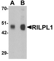 1 - RILPL1 Antibody ASC11378