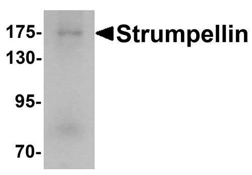 1 - Strumpellin Antibody ASC11379
