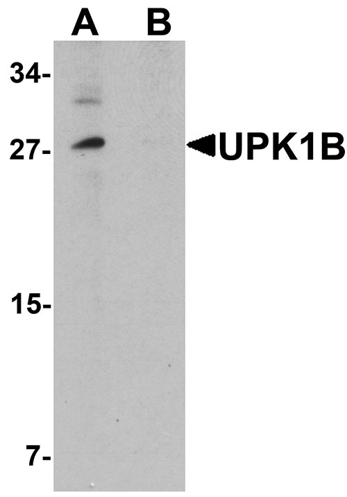 1 - UPK1B Antibody ASC11380