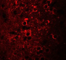 3 - CCDC55 Antibody ASC11384