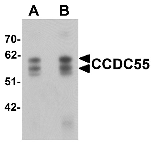 1 - CCDC55 Antibody ASC11384