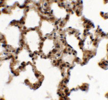 2 - ECRG2 Antibody ASC11386
