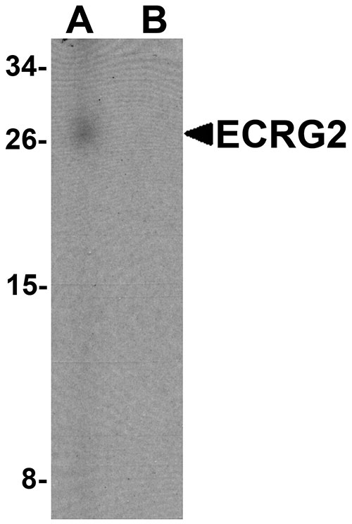1 - ECRG2 Antibody ASC11386
