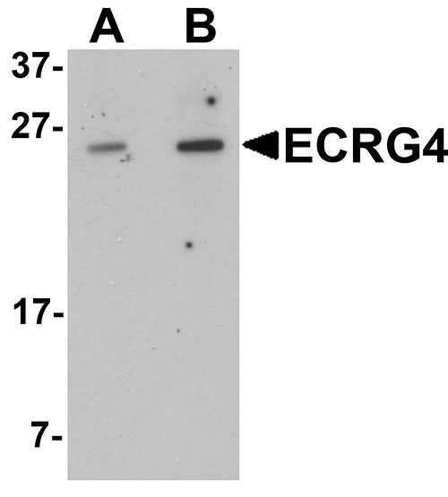 1 - ECRG4 Antibody ASC11387