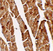 2 - TGM5 Antibody ASC11388