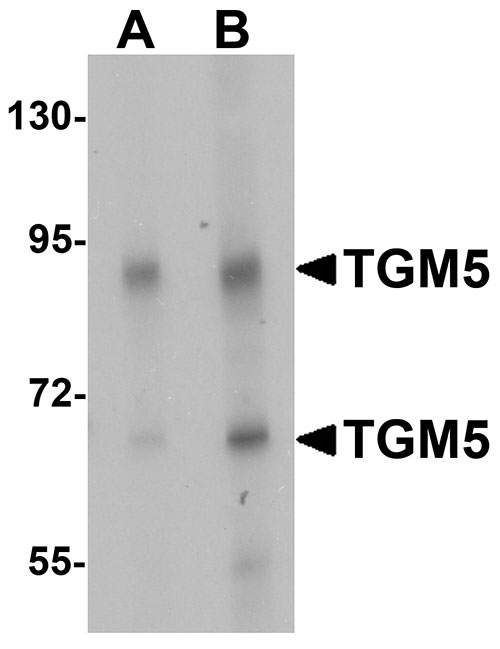 1 - TGM5 Antibody ASC11388