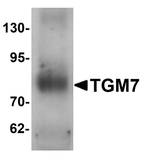 1 - TGM7 Antibody ASC11389